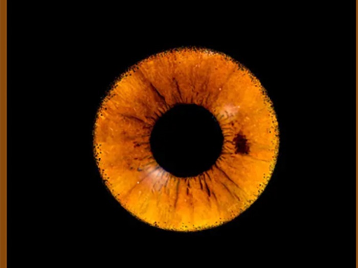 Installation professionnelle pour photographie de l’iris Eyeland en Martinique