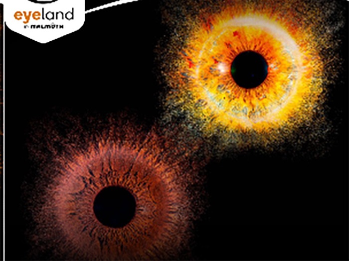 Résultat final de photographie d’iris en haute définition Eyeland en Martinique